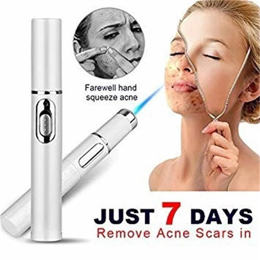 Blue Light Therapy Acne