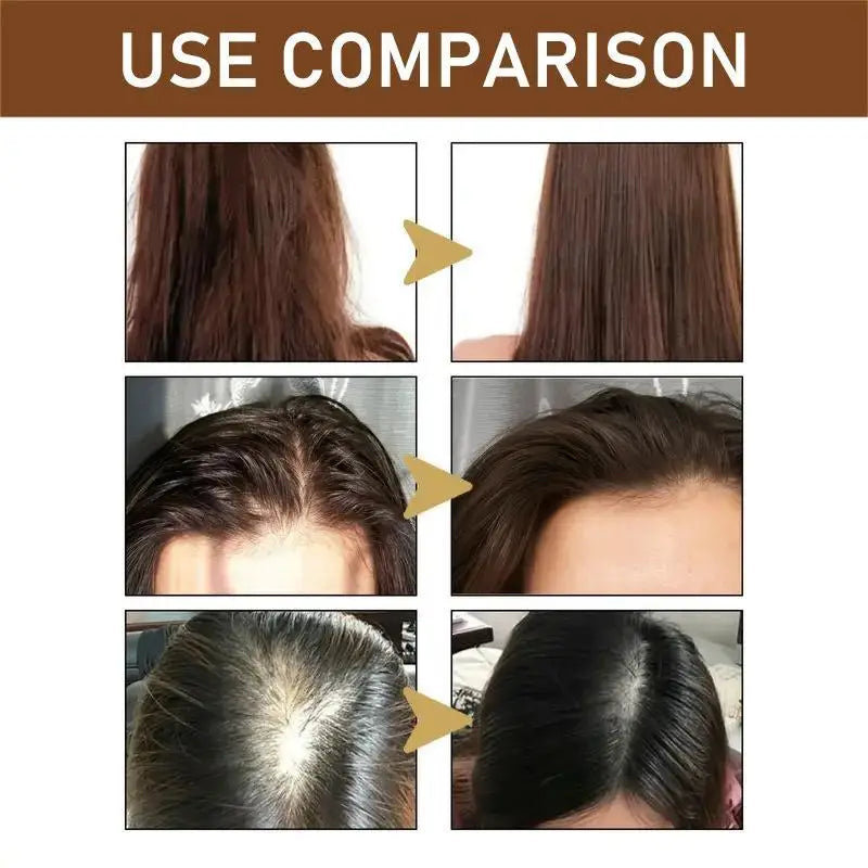 1/2PCS Biotin Hair Growth Shampoo Anti Hair Loss Anti Dandruff Thickening Shampoo For Thinning Hair Regrowth Nourishing Hair