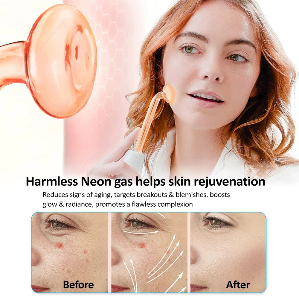 Glass Tube Wand Skin Tightening Remove Wrinkle Acne Spots