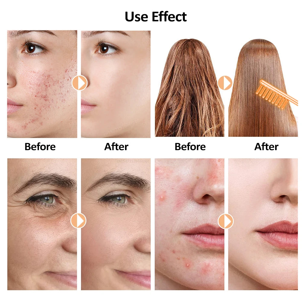 Glass Tube Wand Skin Tightening Remove Wrinkle Acne Spots