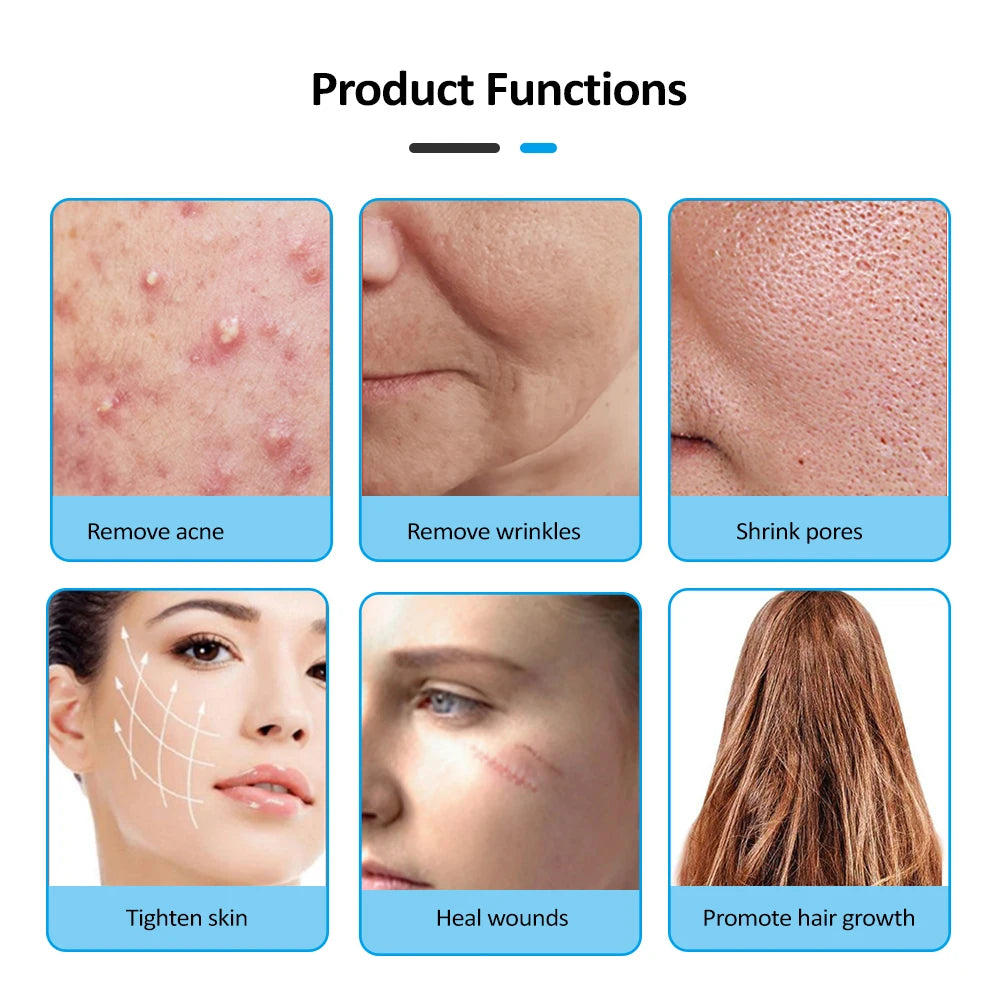 Glass Tube Wand Skin Tightening Remove Wrinkle Acne Spots